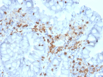 ITGAE Antibody