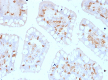 ITGAE Antibody