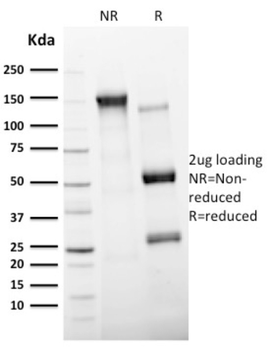 ITGAX Antibody
