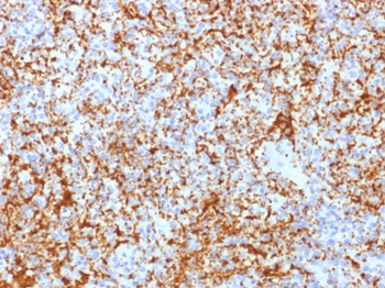ITGB3 Antibody