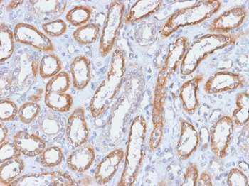ITGB3 Antibody
