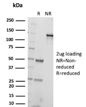 ITGB3 Antibody