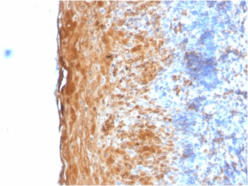 IVL Antibody