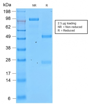 IVL Antibody