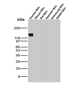 IVL Antibody