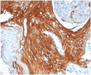 KRT6A Antibody