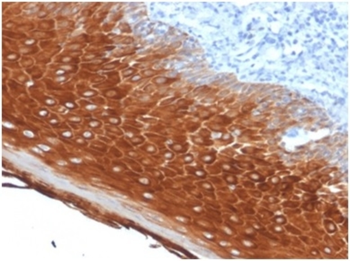 KRT6A Antibody
