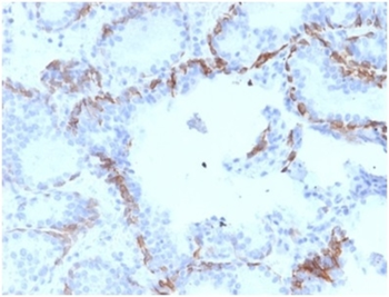 KRT6A Antibody