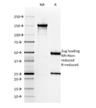 KRT6A Antibody