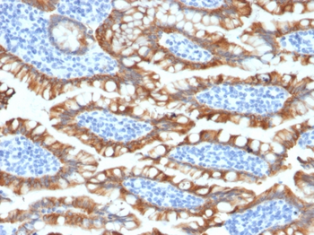 KRT8 Antibody