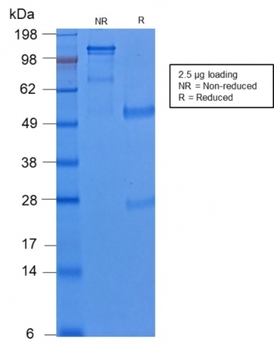 KRT8 Antibody