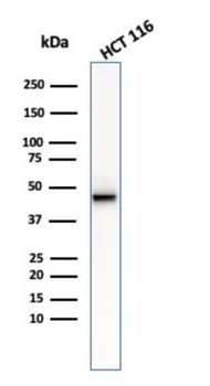 KRT8 Antibody