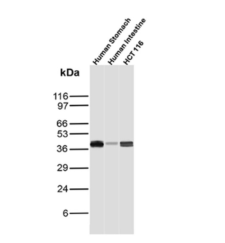 KRT8 Antibody