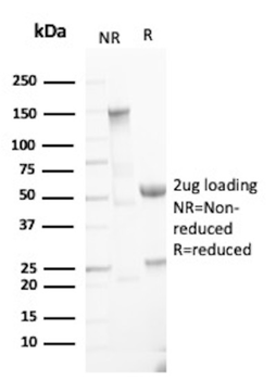 KRT8 Antibody