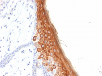 KRT10 Antibody