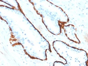 KRT15 Antibody