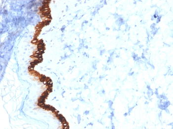 KRT15 Antibody
