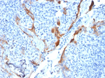 KRT16 Antibody