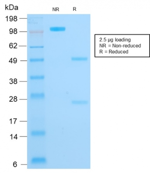 KRT16 Antibody