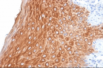 KRT16 Antibody