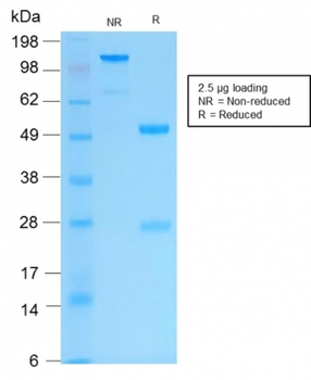 KRT16 Antibody