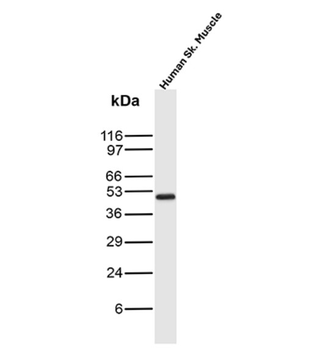 KRT16 Antibody