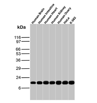 LGALS1 Antibody