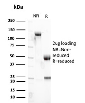 LGALS1 Antibody