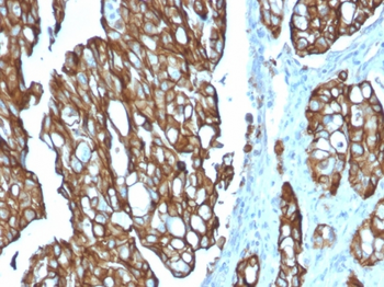 TACSTD2 Antibody