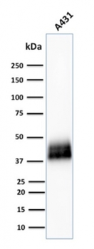 TACSTD2 Antibody