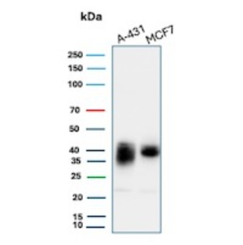 TACSTD2 Antibody