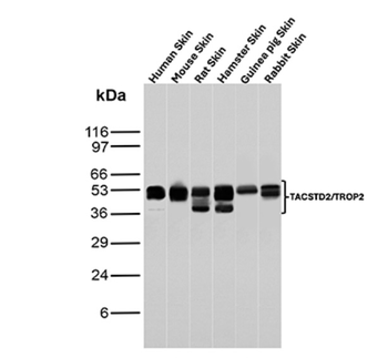 TACSTD2 Antibody