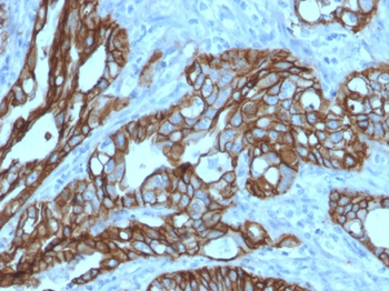 TACSTD2 Antibody