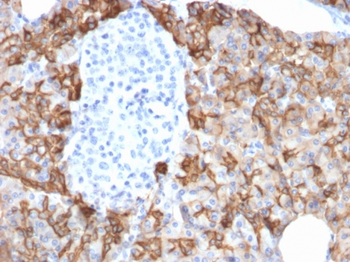 TACSTD2 Antibody