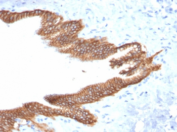 TACSTD2 Antibody