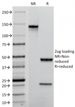 TACSTD2 Antibody