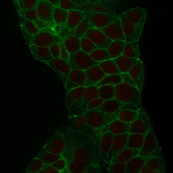 TACSTD2 Antibody