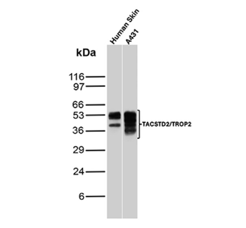 TACSTD2 Antibody