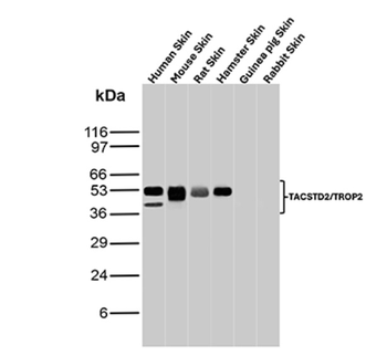 TACSTD2 Antibody