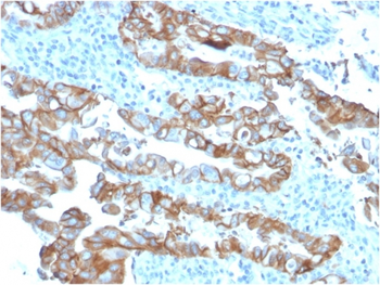 TACSTD2 Antibody