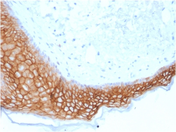 TACSTD2 Antibody