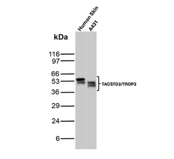 TACSTD2 Antibody