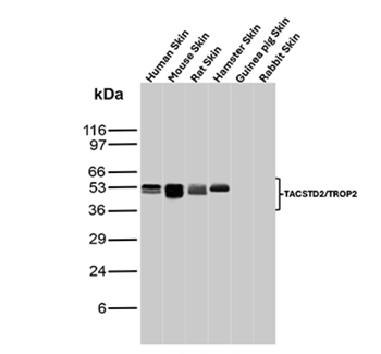 TACSTD2 Antibody
