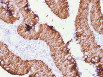 EPCAM Antibody