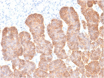 EPCAM Antibody
