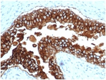 EPCAM Antibody