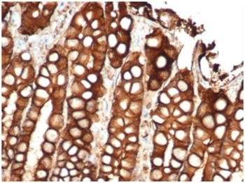 EPCAM Antibody