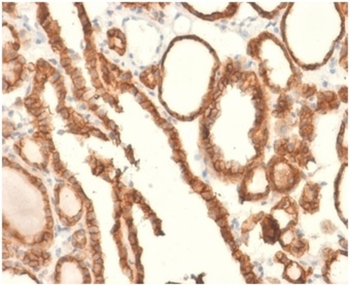 EPCAM Antibody