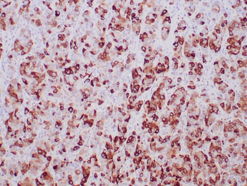 SCGB2A2 Antibody
