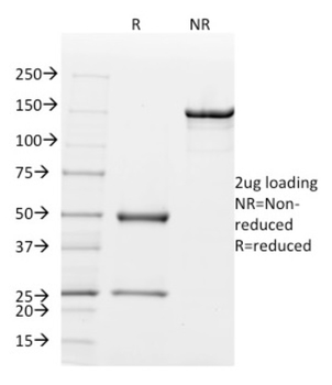 SCGB2A2 Antibody
